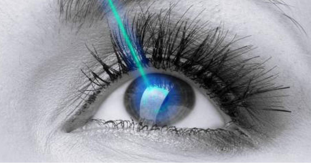 تثبت و علاج القرنية المخروطية في ايران