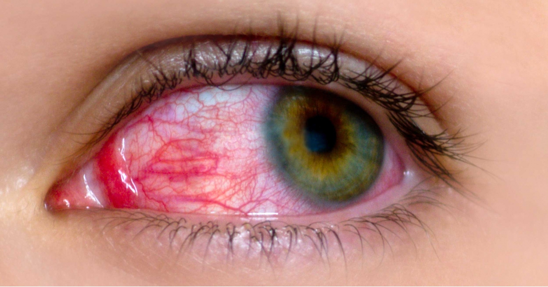 أطباء استشاريين تخصص الغلوكوما مستشفى نور طهران